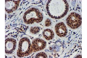 Immunohistochemical staining of paraffin-embedded Human breast tissue using anti-TIMP2 mouse monoclonal antibody. (TIMP2 抗体)