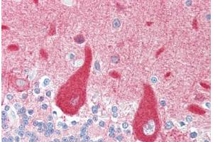 Human Brain, Cerebellum (formalin-fixed, paraffin-embedded) stained with CRMP1 antibody ABIN461920 at 5 ug/ml followed by biotinylated goat anti-rabbit IgG secondary antibody ABIN481713, alkaline phosphatase-streptavidin and chromogen. (CRMP1 抗体  (N-Term))