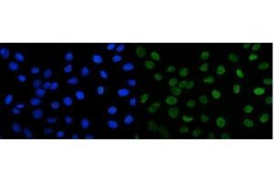 anti-Forkhead Box K1 (Foxk1) (AA 175-671) antibody