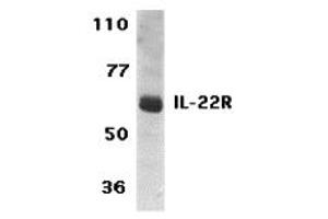 Western Blotting (WB) image for anti-Interleukin 22 Receptor (IL22R) (C-Term) antibody (ABIN1030435) (IL22R 抗体  (C-Term))