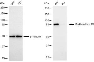 Western blotting analysis using forkhead box P1 antibody (ABIN7798651).