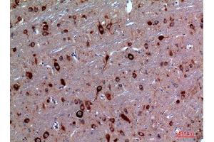 Immunohistochemistry (IHC) image for anti-Transient Receptor Potential Cation Channel, Subfamily C, Member 3 (TRPC3) (Internal Region) antibody (ABIN6283972)