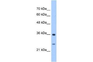 GSTZ1 antibody used at 2. (GSTZ1 抗体)