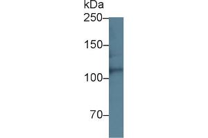 Detection of HSPG2 in Mouse Lung lysate using Polyclonal Antibody to Heparan Sulfate Proteoglycan 2 (HSPG2) (HSPG2 抗体  (AA 4149-4391))