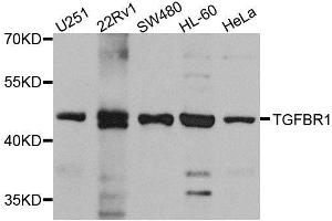 Western blot analysis of extracts of various cell lines, using TGFBR1 antibody. (TGFBR1 抗体  (AA 34-124))