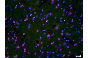 Formalin-fixed and paraffin-embedded rat brain labeled with Anti-Phospho-HER3(Tyr1328) Polyclonal Antibody, Unconjugated (ABIN800628) 1:200, overnight at 4°C, The secondary antibody was Goat Anti-Rabbit IgG, Cy3 conjugated used at 1:200 dilution for 40 minutes at 37°C. (ERBB3 抗体  (pTyr1328))