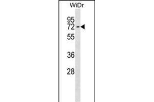 CTNNBL1 Antibody (N-term) (ABIN1539081 and ABIN2848704) western blot analysis in WiDr cell line lysates (35 μg/lane). (CTNNBL1 抗体  (N-Term))