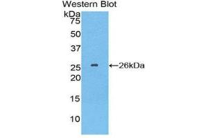 Western Blotting (WB) image for anti-Tubulin Polymerization Promoting Protein (Tppp) (AA 8-210) antibody (ABIN1860848) (Tppp 抗体  (AA 8-210))