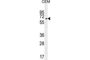 UNCX Antibody (C-term) western blot analysis in CEM cell line lysates (35 µg/lane). (UNCX 抗体  (C-Term))