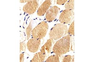 Immunohistochemical analysis of paraffin-embedded H. (CARD6 抗体)