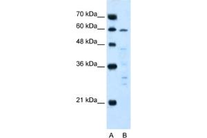 Western Blotting (WB) image for anti-Interleukin 10 Receptor, alpha (IL10RA) antibody (ABIN2462831) (IL-10RA 抗体)
