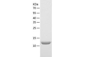 Western Blotting (WB) image for Mediator Complex Subunit 21 (MED21) (AA 1-144) protein (His tag) (ABIN7123872)