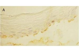 Immunohistochemistry image of Laminin 5 staining in cryosection of bullous pemphigoid Skin. (Laminin 5 抗体)