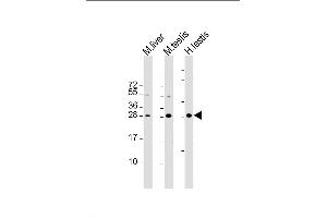 Lane 1: mouse liver lysates, Lane 2: mouse testis lysates, Lane 3: human testis lysates, probed with CDX1 (937CT11. (CDX1 抗体)