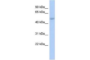 WB Suggested Anti-LHX5 Antibody Titration: 0. (LHX5 抗体  (Middle Region))