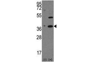 Western Blotting (WB) image for anti-Nanog Homeobox (NANOG) (AA 15-49) antibody (ABIN3031942)