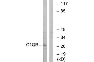 Western blot analysis of extracts from Jurkat cells, using C1QB antibody. (C1QB 抗体  (C-Term))