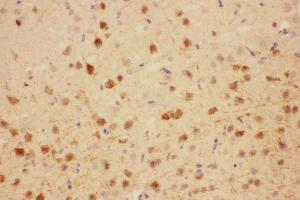 Anti-MAG antibody, IHC(P) IHC(P): Rat Brain Tissue (MAG 抗体  (N-Term))
