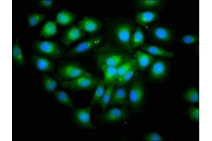 Immunofluorescence staining of A549 cells with ABIN7166112 at 1:200, counter-stained with DAPI. (SHISA5 抗体  (AA 56-137))