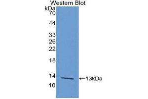 Western Blotting (WB) image for anti-Polymeric Immunoglobulin Receptor (PIGR) (AA 135-237) antibody (ABIN1174192)