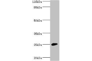 Western blot All lanes: CALN1 antibody at 2 μg/mL + Mouse brain tissue Secondary Goat polyclonal to rabbit IgG at 1/10000 dilution Predicted band size: 25, 30 kDa Observed band size: 25 kDa (Calneuron 1 抗体  (AA 1-192))