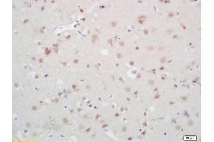 Formalin-fixed and paraffin embedded rabbit brain labeled with Rabbit Anti Phospho-NMDAR2B (Tyr1070) Polyclonal Antibody, Unconjugated (ABIN744353) at 1:200 followed by conjugation to the secondary antibody and DAB staining (GRIN2B 抗体  (pTyr1070))