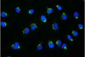 IF analysis of GCC1 using anti-GCC1 antibody (ABIN7600700).