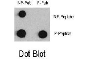 Dot blot analysis of MEF2C (phospho S387) polyclonal antibody  and anti-MEF2C Non Phospho-specific polyclonal antibody on nitrocellulose membrane. (MEF2C 抗体  (pSer387))