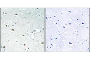Immunohistochemistry analysis of paraffin-embedded human brain tissue, using Retinoblastoma (Ab-826) Antibody.