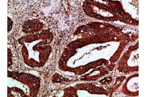 Immunohistochemistry (IHC) image for anti-Inhibitor of kappa Light Polypeptide Gene Enhancer in B-Cells, Kinase gamma (IKBKG) (AA 60-120) antibody (ABIN7189515)