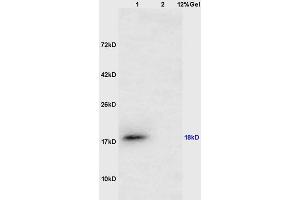 Lane 1: mouse testis lysates Lane 2: mouse lung lysates probed with Anti CTAG1B/Cancer/testis antigen 1 Polyclonal Antibody, Unconjugated (ABIN1385261) at 1:200 in 4 °C. (CTAG1B 抗体  (AA 81-180))