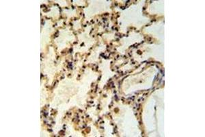 Immunohistochemistry (Paraffin-embedded Sections) (IHC (p)) image for anti-Inner Mitochondrial Membrane Peptidase Subunit 2 (IMMP2L) (AA 88-117), (Middle Region) antibody (ABIN952890)