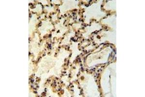 Immunohistochemistry analysis in formalin fixed and paraffin embedded rat lung tisssue reacted with IMMP2L Antibody (Center) followed by peroxidase conjugation of the secondary antibody and DAB staining. (IMMP2L 抗体  (Middle Region))