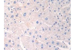 Detection of ADRP in Human Liver Tissue using Polyclonal Antibody to Adipose Differentiation Related Protein (ADRP) (ADRP 抗体  (AA 245-433))