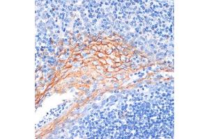 Immunohistochemistry of paraffin-embedded human tonsil using AREG antibody (ABIN6127431, ABIN6137065, ABIN6137066 and ABIN6216408) at dilution of 1:100 (40x lens). (Amphiregulin 抗体  (AA 20-252))
