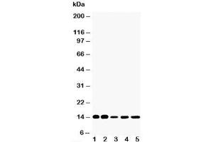 Western blot testing of FABP1 antibody and Lane 1:  rat liver;  2: rat kidney;  3: HeLa;  4: (mouse) Neuro-2a;  5: (human) SMMC-7721 cell lysate (FABP1 (liver) 抗体  (N-Term))