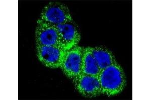 Confocal immunofluorescent analysis of IGF1R antibody with WiDr cells followed by Alexa Fluor 488-conjugated goat anti-rabbit lgG (green). (IGF1R 抗体  (AA 51-77))