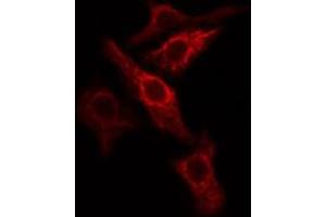 ABIN6274786 staining COLO205 cells by IF/ICC. (PGLS 抗体  (C-Term))