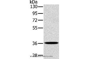 Western blot analysis of A172 cell, using PDLIM1 Polyclonal Antibody at dilution of 1:400 (PDLIM1 抗体)