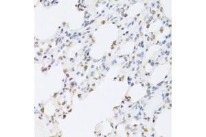 Immunohistochemistry of paraffin-embedded rat lung using SFN Antibody. (14-3-3 sigma/SFN 抗体  (AA 1-248))