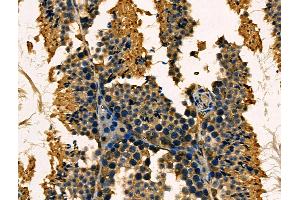 ABIN6263783 and ABIN6266750 at 1/100 staining Mouse testis tissue by IHC-P.