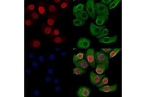 Phospho-Lamin A/C (Ser390) Antibody staining Hela cells(heat shock treatment) by IF/ICC. (Lamin A/C 抗体  (pSer390))