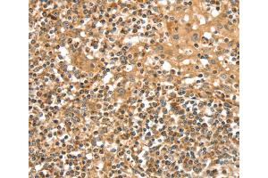 Immunohistochemistry (IHC) image for anti-Solute Carrier Family 8 (Sodium/calcium Exchanger), Member 3 (SLC8A3) antibody (ABIN2427255) (SLC8A3 抗体)