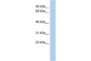WB Suggested Anti-WDPCP Antibody Titration: 0. (WDPCP 抗体  (N-Term))