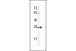 Western blot analysis of CWC15 Antibody (Center) (ABIN651004 and ABIN2840035) in CHO cell line lysates (35 μg/lane). (CWC15 抗体  (AA 123-152))