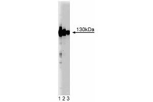 Western blot analysis of EphA4 on rat brain lysate. (EPH Receptor A4 抗体  (AA 279-472))