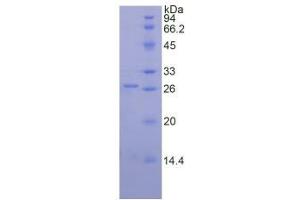 SDS-PAGE analysis of Mouse Proteinase 3 Protein. (PRTN3 蛋白)
