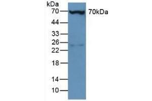 Detection of PLS3 in Mouse Liver Tissue using Polyclonal Antibody to Plastin 3 (PLS3) (Plastin 3 抗体  (AA 5-251))