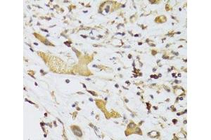 Immunohistochemistry (Paraffin-embedded Sections) (IHC (p)) image for anti-Glycerol Phosphate Dehydrogenase 2, Mitochondrial (GPD2) antibody (ABIN7011245)