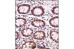 BANF1 Antibody (Center) ((ABIN657992 and ABIN2846938))immunohistochemistry analysis in formalin fixed and paraffin embedded human colon tissue followed by peroxidase conjugation of the secondary antibody and DAB staining. (BANF1 抗体  (AA 37-65))